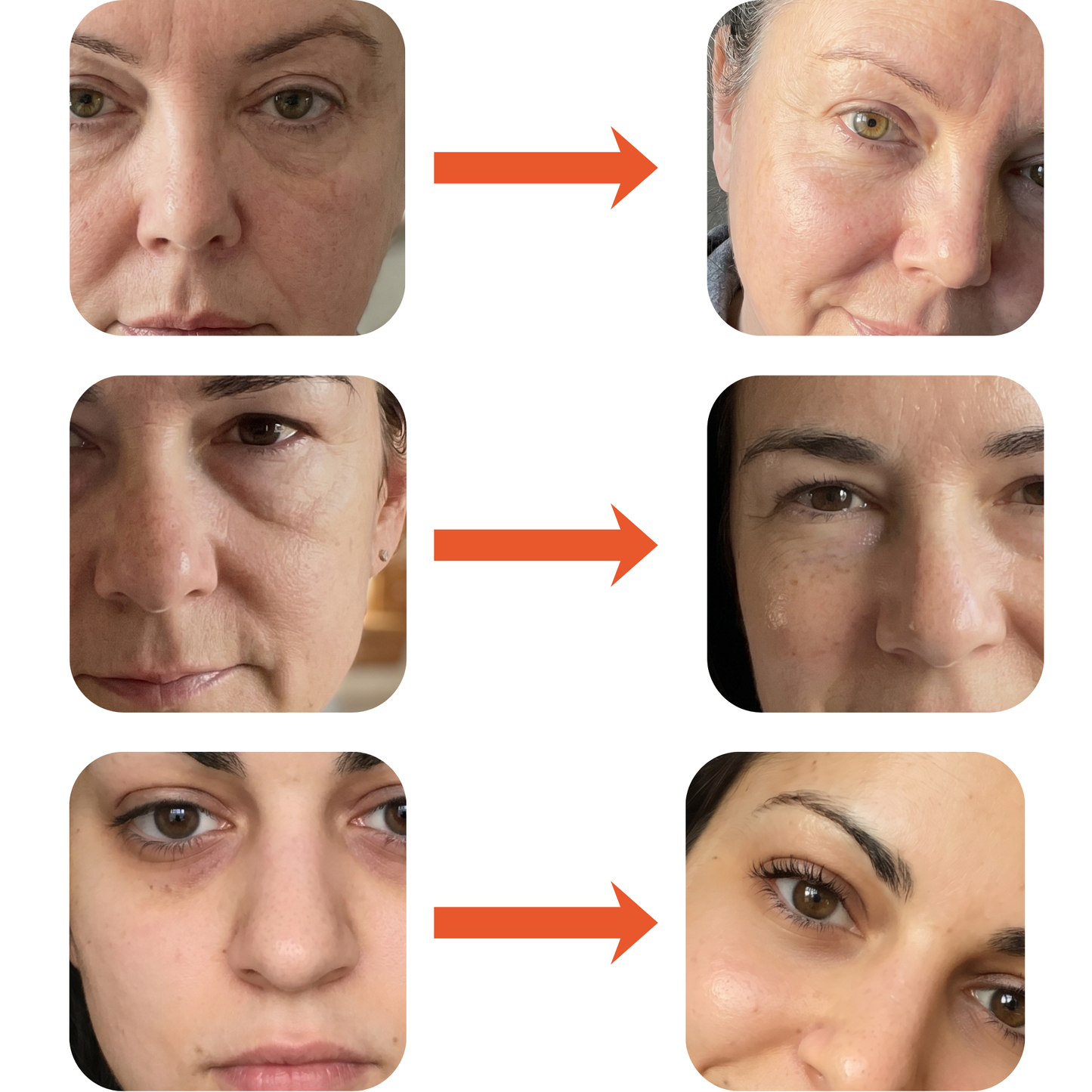 Revaura™ Sleep Aid 2.0